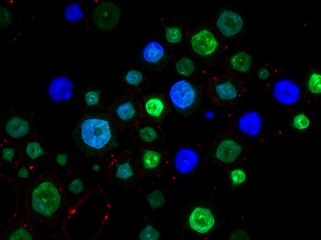 Fluorescence microscopy of human skeletal stem cells in an NSG mouse xenograft